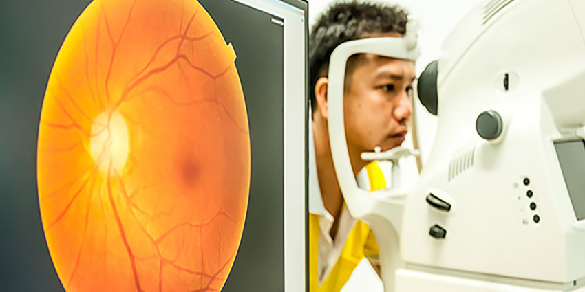 Retinal scan showing signs of diabetic retinopathy with visible blood vessel abnormalities