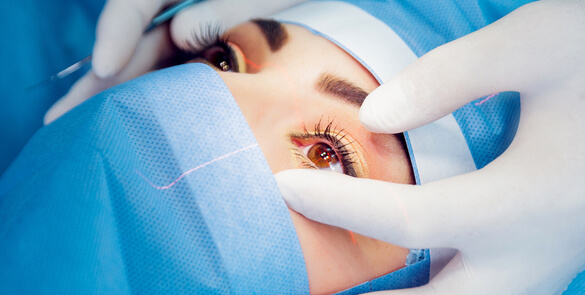 Close-up of a patient undergoing eye surgery, with clinical preparation and sterile draping visible.