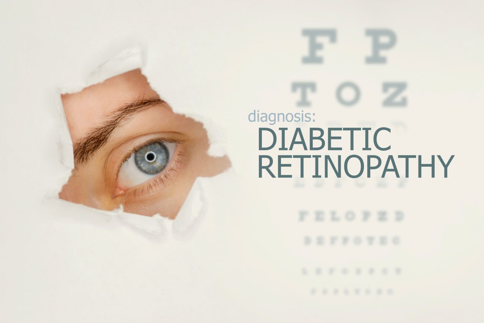 Close up of eye peering through torn paper printed with the words: diagnosis: diabetic retinopathy.